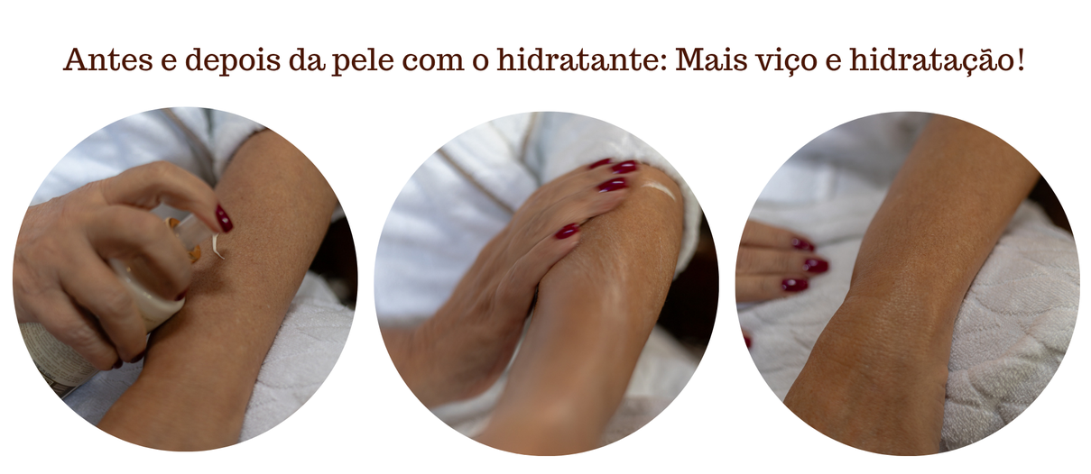 Antes e depois da pele com o hidratante Mais vio e hidratao 2500 x 870 px 2000 x 870 px 2