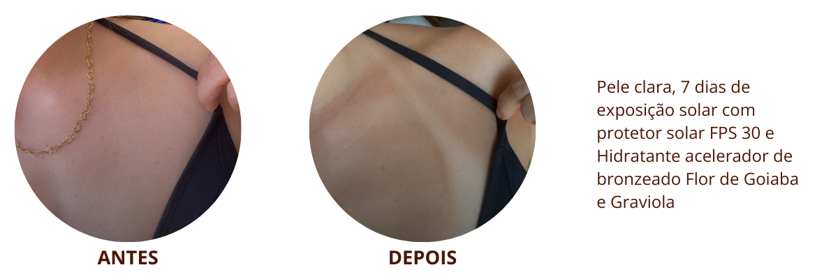 Reserva   Antes Depois   Acelerador de Bronzeado 1